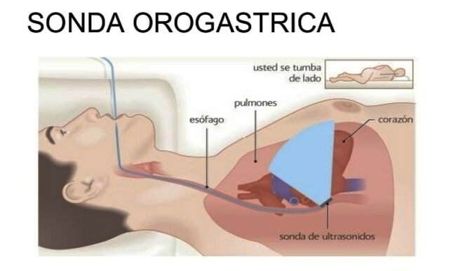 Aceptación de nutrición orogástrica