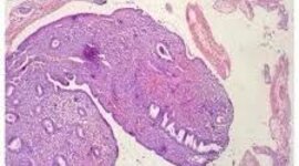 Timeline: Principales descubrimientos y aportaciones en el área de Histología y sus personajes involucrados. Valeria Prieto Espino Grupo:242 UA: Histologia