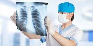 IMPORTANCIA, RAYOS X