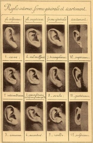 Sistema Otométrico de Frigerio