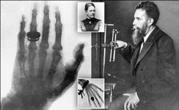 The discovery of x-rays