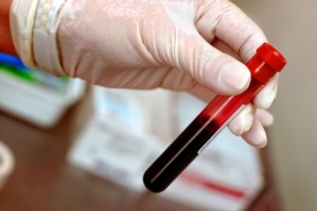 1853. Primeros estudios para la identificación de la sangre.