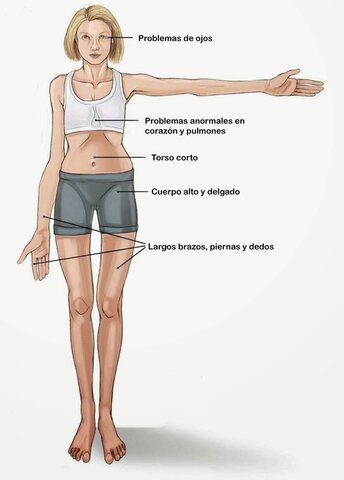 Comportamiento mendeliano recesivo