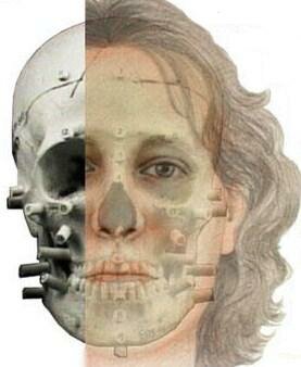 Antropología forense