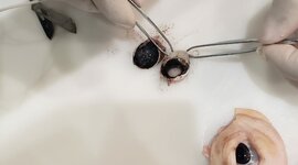 Timeline: DESAROLLO CRONOLOGICO DE LAS ESTRUCTURAS OCULARES  DURANTE EL PERIODO DE EMBRIOGENESIS