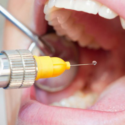 Timeline: HISTORIA DE LA ANESTESIA LOCAL Y GENERAL