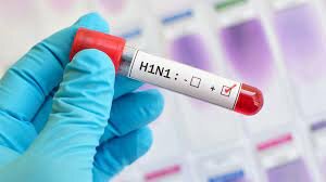 The H1N1 Influenza.
