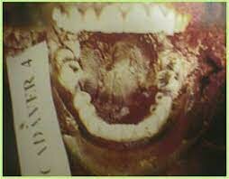 Sistema dentario de Amoedo