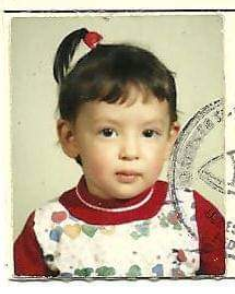 Caída 2 años de edad