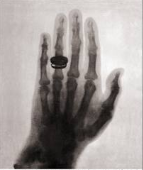 Rontgen obtuvo la imagen de la mano de su esposa