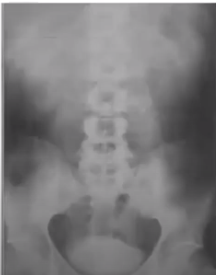 Osborne muestra el uso de componentes solubles como medio de contraste