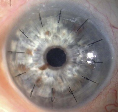Sistema Ocular