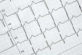 Electrocardiografía
