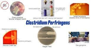 Clostridium perfringens