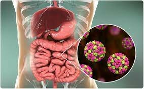 Norovirus