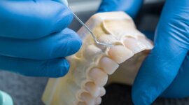 Timeline: Historia de la Odontología Restauradora