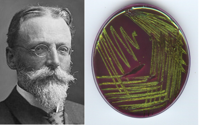 ESCHERICHIA COLI-Escherich