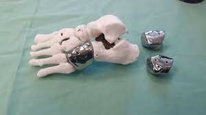 Aumento de la impresión 3D.