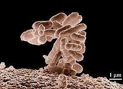 ESCHERICHIA COLI