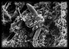 LEGIONELLA PNEUMOPHILIA