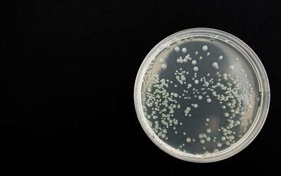 BACTERIAS EN VIAJES INTERPLANETARIOS