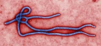 Virus del ebola