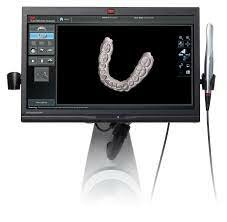 Técnica de Impresión Digital