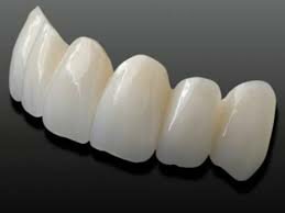 Restauraciones de cerámica sin metal