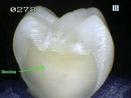 Formación de dentina