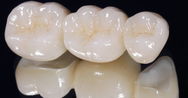 Primer diente de porcelana