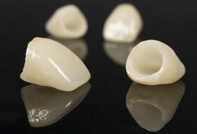 Corona de chaqueta de porcelana