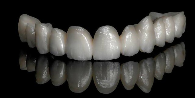 Zirconia In-Ceram