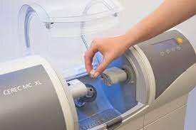 Sistema Cerec (CAD/CAM)