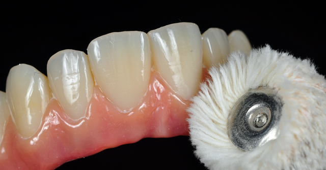 Composites. El material de restauración.