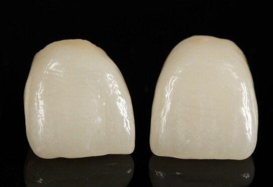 Restauraciones libres de metal