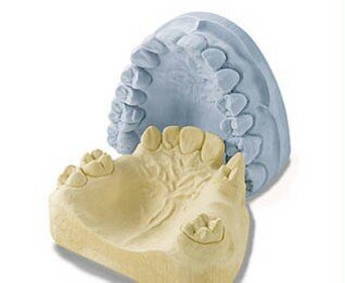 Introducción de las impresiones con yeso