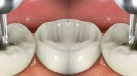 Timeline: Evolución de la Odontología Restauradora (1990-2021)