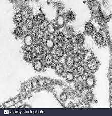 Primera micrografía de electrones