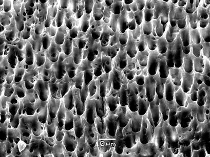 Grabado acido del esmalte