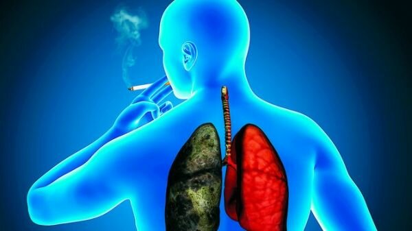 Asociación del cáncer pulmonar