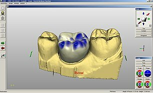 CAD/CAM