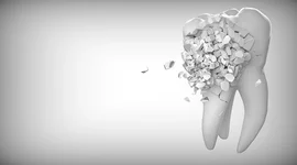 Timeline: Evolución de la odontología restauradora