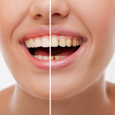 Timeline: Odontología Restauradora