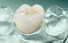 Patente de coronas de ceramica