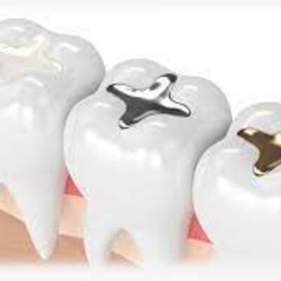 Timeline: EVOLUCIÓN DE LA ODONTOLOGÍA RESTAURADORA HASTA LA ACTUALIDAD - Andrea Antuna