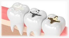 Timeline: EVOLUCIÓN DE LA ODONTOLOGÍA RESTAURADORA HASTA LA ACTUALIDAD - Andrea Antuna