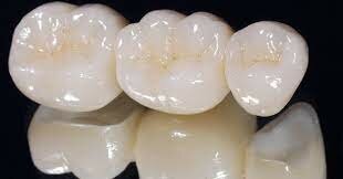 Primer uso de porcelana en odontología