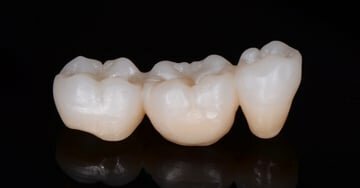 Restauraciones de ceramica sin metal