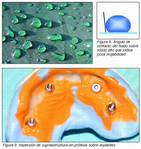 Poliéteres, silicona de adición y condensación