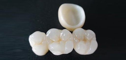 In-Ceram zirconia